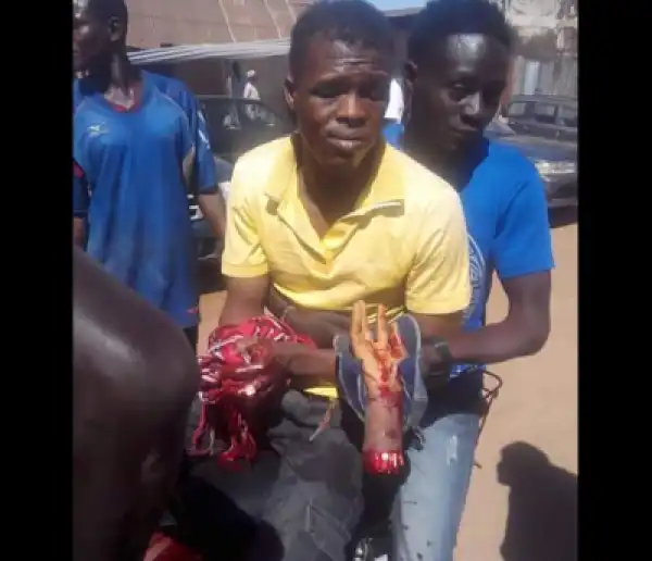 Shocking..! Hoodlums Cuts Off Young Man